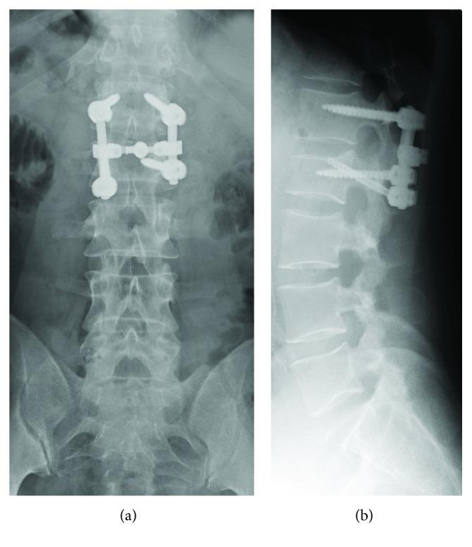 https://cdn.ncbi.nlm.nih.gov/pmc/blobs/64b6/6015715/f9b1265a0afc/CRIOR2018-8185051.003.jpg