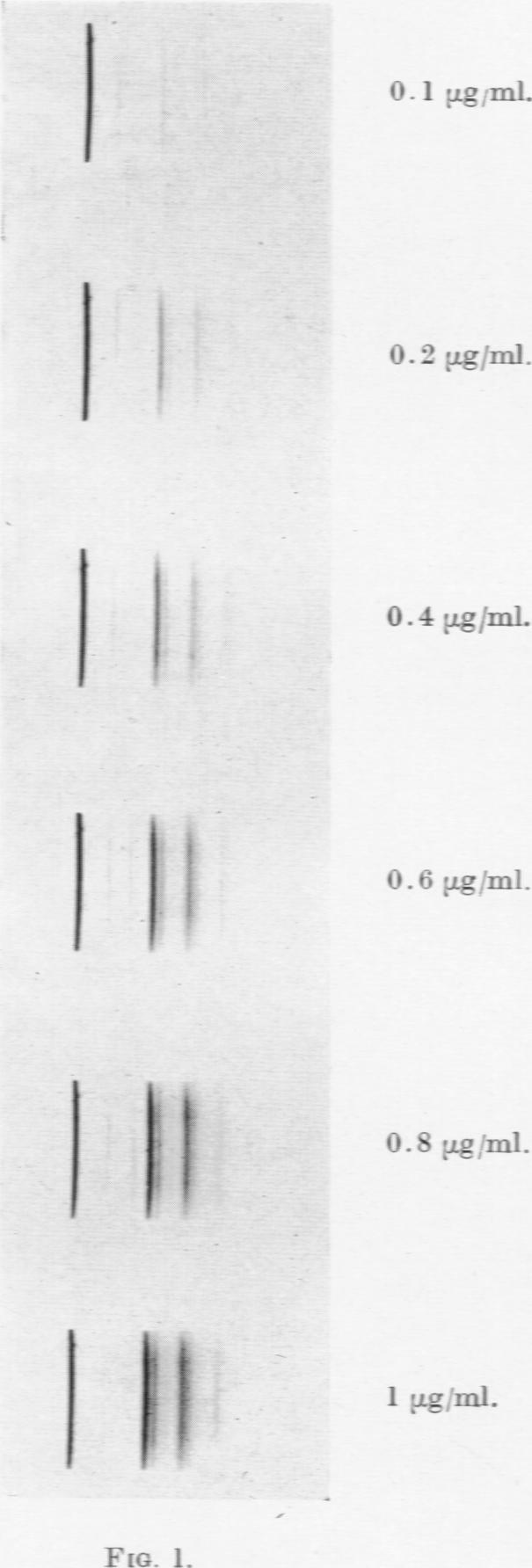 https://cdn.ncbi.nlm.nih.gov/pmc/blobs/64b9/2007564/a55e17b583fd/brjcancer00406-0180-a.jpg
