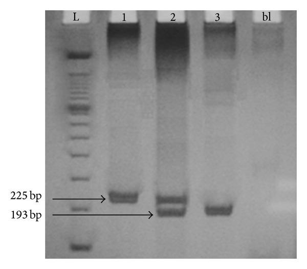 https://cdn.ncbi.nlm.nih.gov/pmc/blobs/64b9/4009163/0fa3a2ce74be/AH2014-924030.001.jpg
