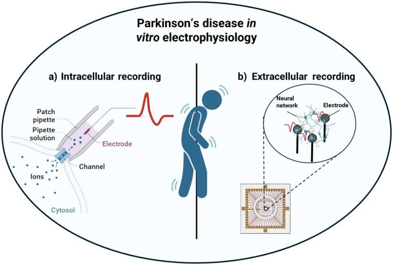 https://cdn.ncbi.nlm.nih.gov/pmc/blobs/64c2/12075271/7d6ed6e9089a/fnins-19-1584555-g001.jpg