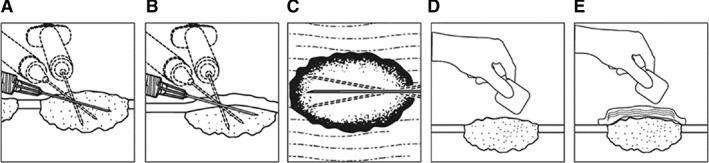 https://cdn.ncbi.nlm.nih.gov/pmc/blobs/64c4/7066689/37a384daa686/ONCO-25-e423-g003.jpg