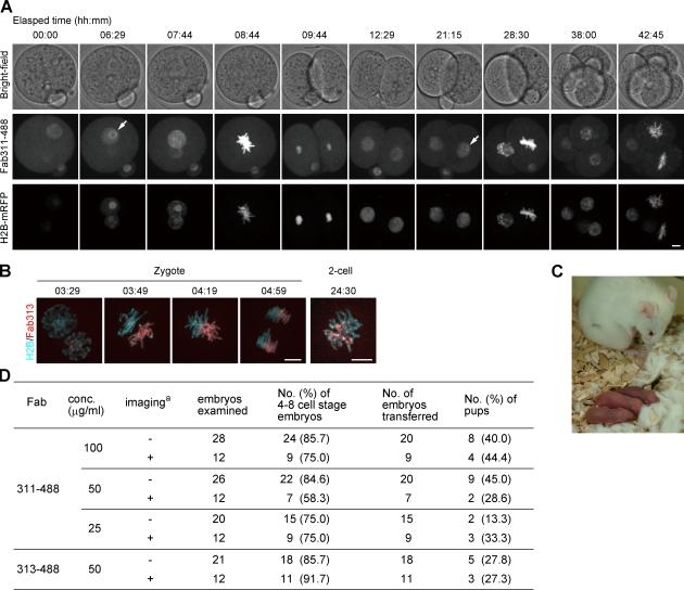 https://cdn.ncbi.nlm.nih.gov/pmc/blobs/64ca/2806314/20debf361caf/JCB_200904137_RGB_Fig2.jpg