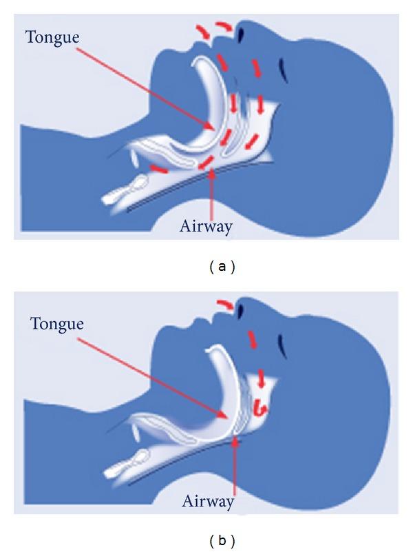 https://cdn.ncbi.nlm.nih.gov/pmc/blobs/64d2/3877588/8824bb1b1dcb/CRP2013-356280.001.jpg