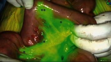 https://cdn.ncbi.nlm.nih.gov/pmc/blobs/64d2/8844395/4462906030cd/CRIS2022-5459774.004.jpg