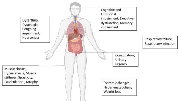 https://cdn.ncbi.nlm.nih.gov/pmc/blobs/64d5/8802668/e1b1406e4864/fneur-12-788462-g0002.jpg