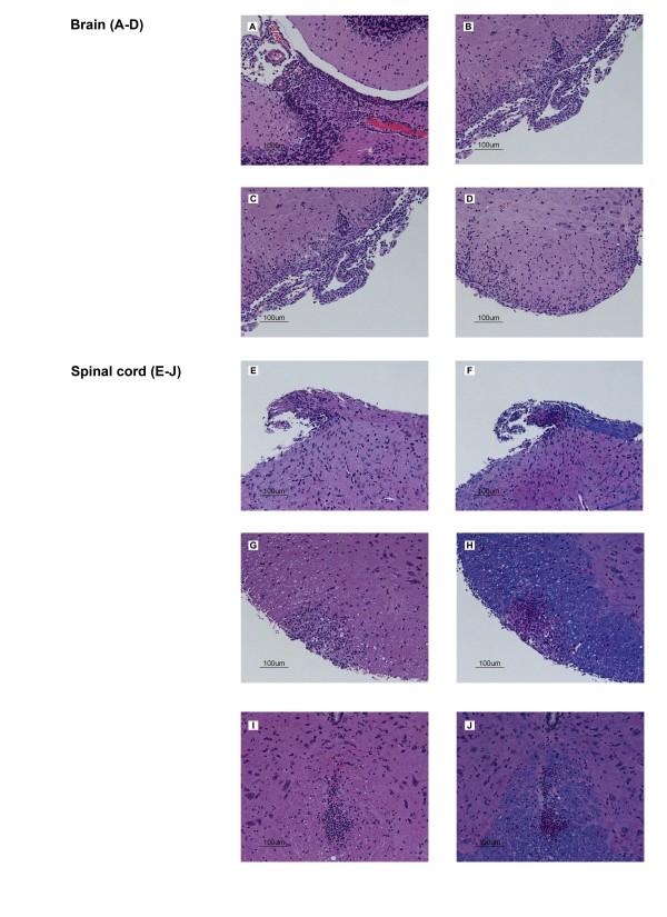 https://cdn.ncbi.nlm.nih.gov/pmc/blobs/64db/3161869/955bb793b668/1742-2094-8-73-3.jpg