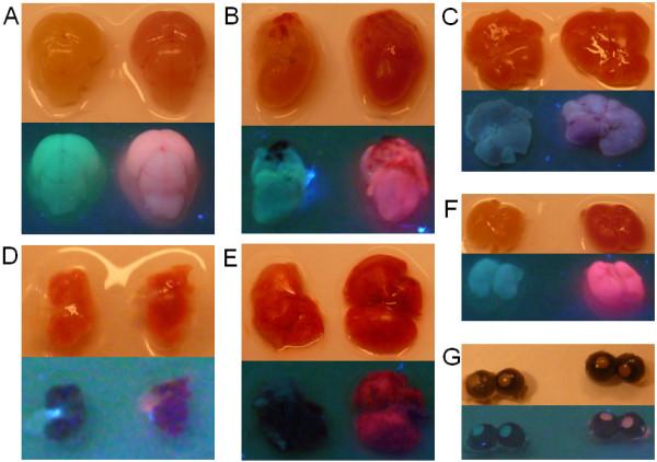 https://cdn.ncbi.nlm.nih.gov/pmc/blobs/64df/3434021/e0239c0de927/1756-0500-5-296-3.jpg