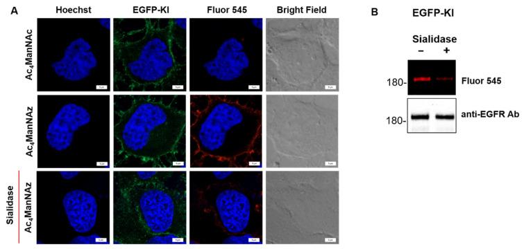 https://cdn.ncbi.nlm.nih.gov/pmc/blobs/64e9/9368999/3cf85c55d534/ijms-23-08754-g004.jpg