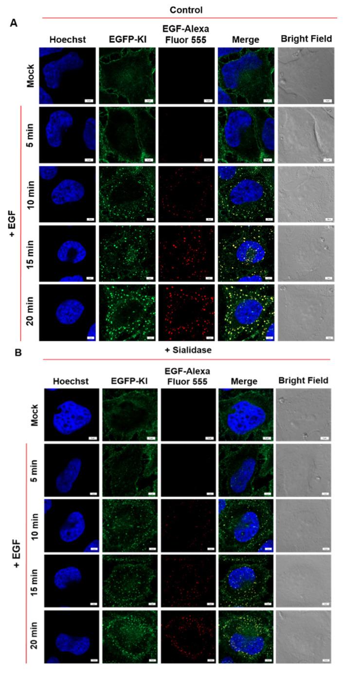 https://cdn.ncbi.nlm.nih.gov/pmc/blobs/64e9/9368999/bdd50873d5ad/ijms-23-08754-g005a.jpg