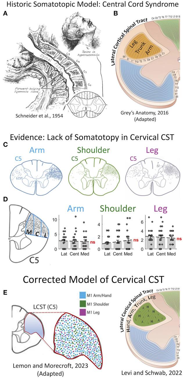https://cdn.ncbi.nlm.nih.gov/pmc/blobs/64ef/10690824/daf6b635e014/fneur-14-1276399-g0001.jpg