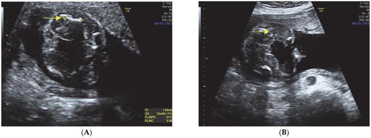 https://cdn.ncbi.nlm.nih.gov/pmc/blobs/64f4/10528460/64c55fd19809/diagnostics-13-02905-g001.jpg