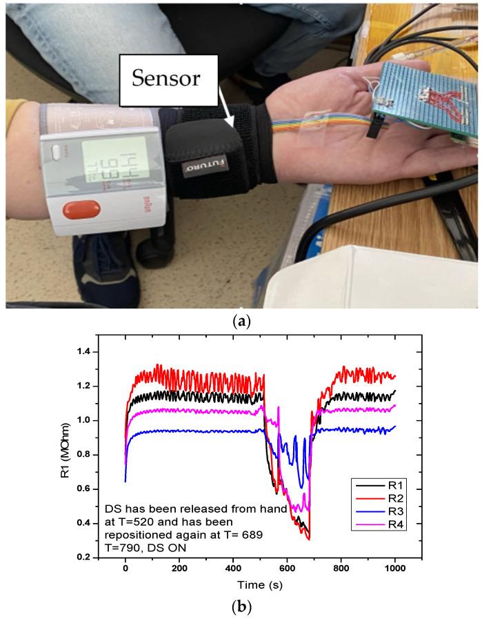 https://cdn.ncbi.nlm.nih.gov/pmc/blobs/64f7/8000553/5b9a06da16e7/sensors-21-02075-g010.jpg