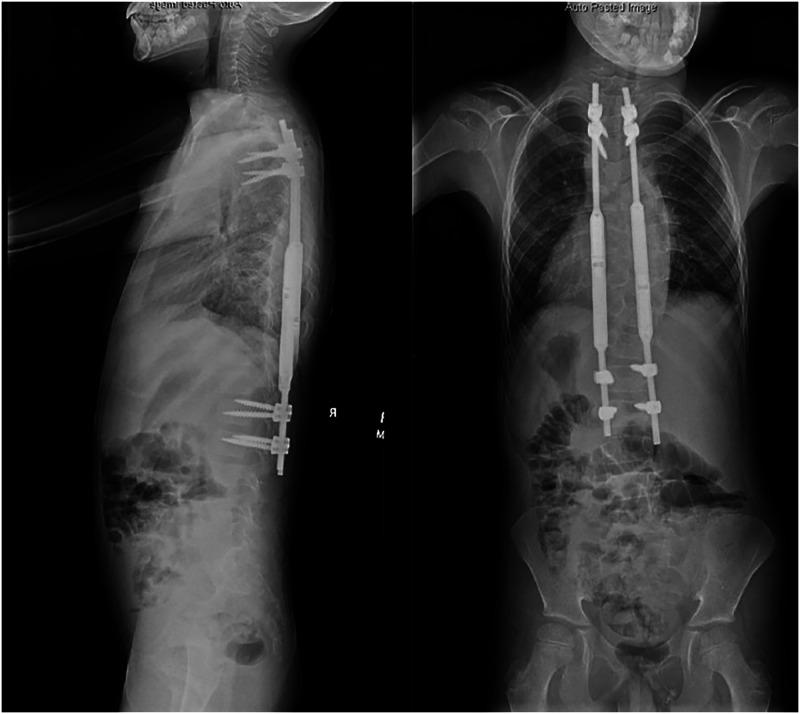 https://cdn.ncbi.nlm.nih.gov/pmc/blobs/64f8/11754134/22f92d77f6ea/gr2.jpg