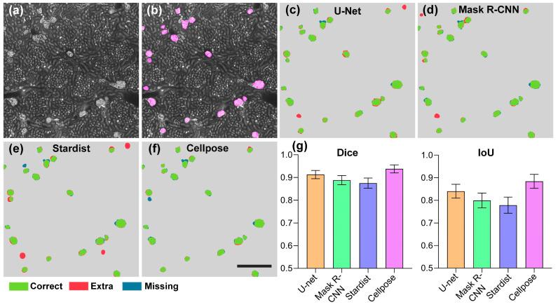 https://cdn.ncbi.nlm.nih.gov/pmc/blobs/64f9/10706842/f7983e25a844/cells-12-02753-g004.jpg