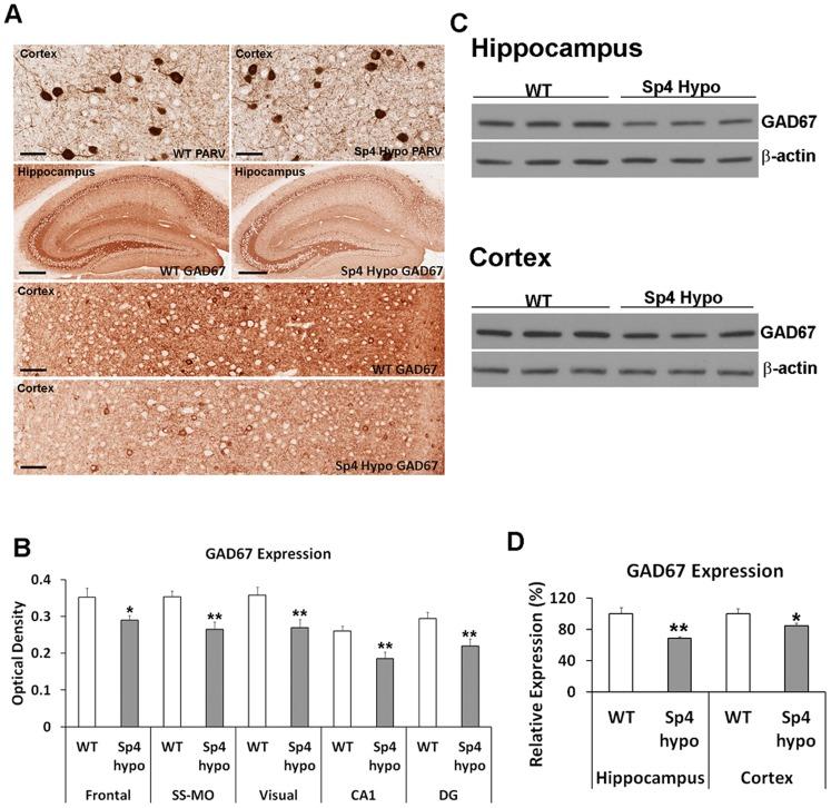 https://cdn.ncbi.nlm.nih.gov/pmc/blobs/64fd/3688895/909f4b8b4b64/pone.0066327.g005.jpg