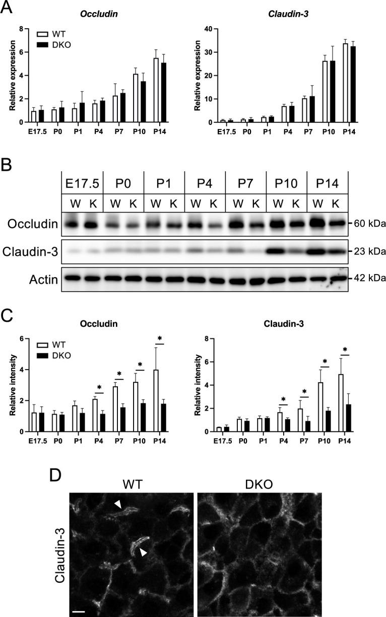 https://cdn.ncbi.nlm.nih.gov/pmc/blobs/64fe/11930773/782d09cba5f5/csf_49_24046-f005.jpg