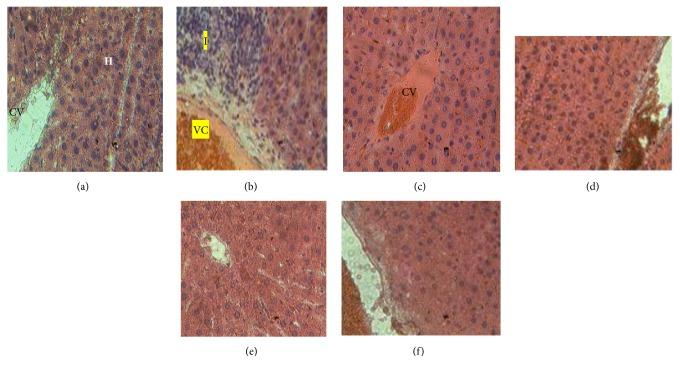 https://cdn.ncbi.nlm.nih.gov/pmc/blobs/64fe/6286743/28dc0f3c3a9c/BMRI2018-4907648.002.jpg