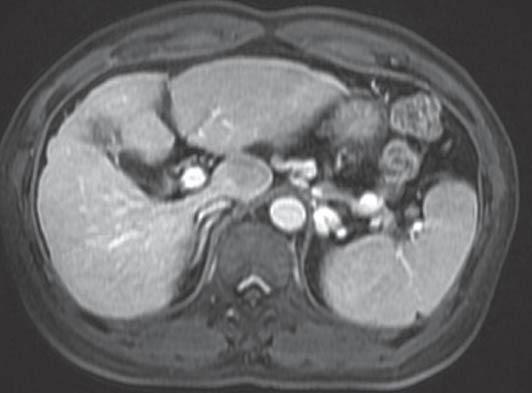 https://cdn.ncbi.nlm.nih.gov/pmc/blobs/64ff/3959931/1e5e64107177/AnnGastroenterol-26-150-g001.jpg