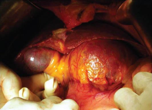 https://cdn.ncbi.nlm.nih.gov/pmc/blobs/64ff/3959931/d6ecc05011a9/AnnGastroenterol-26-150-g006.jpg