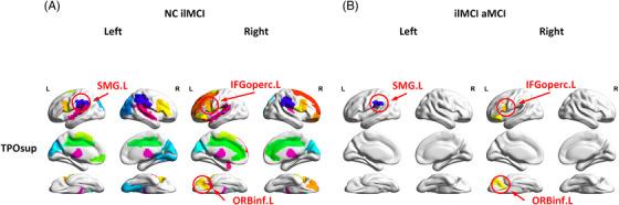 https://cdn.ncbi.nlm.nih.gov/pmc/blobs/6508/11497662/5c89f9c87378/ALZ-20-6566-g004.jpg