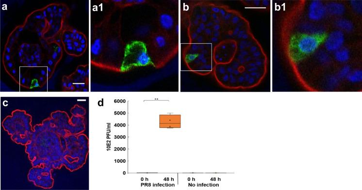 https://cdn.ncbi.nlm.nih.gov/pmc/blobs/6509/7979936/24c1f8a88660/42003_2021_1901_Fig9_HTML.jpg