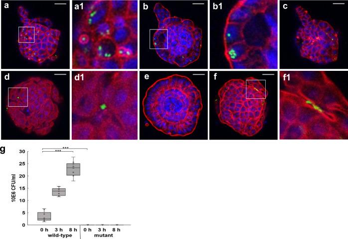 https://cdn.ncbi.nlm.nih.gov/pmc/blobs/6509/7979936/3d2d05c6a54c/42003_2021_1901_Fig8_HTML.jpg