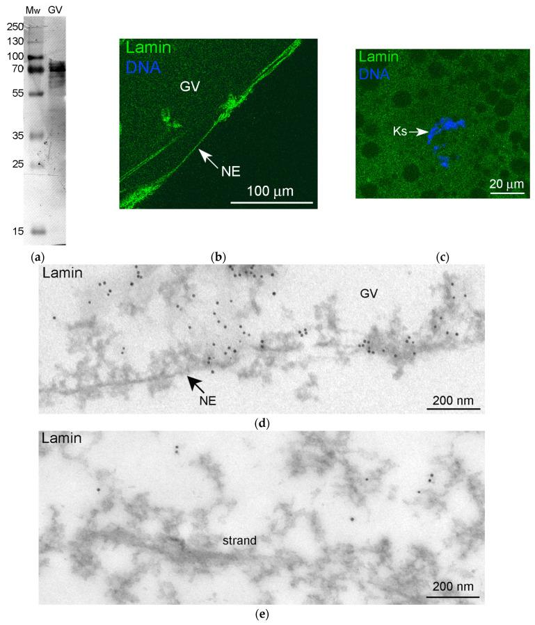 https://cdn.ncbi.nlm.nih.gov/pmc/blobs/650c/10744300/761b1eea9706/jdb-11-00044-g007.jpg