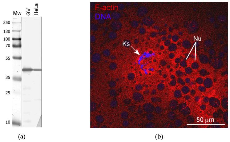 https://cdn.ncbi.nlm.nih.gov/pmc/blobs/650c/10744300/caf4f74847b0/jdb-11-00044-g005.jpg