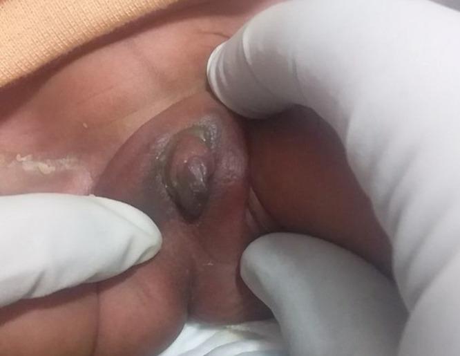 https://cdn.ncbi.nlm.nih.gov/pmc/blobs/650d/10042168/e0f821e0d43f/IMCRJ-16-193-g0002.jpg
