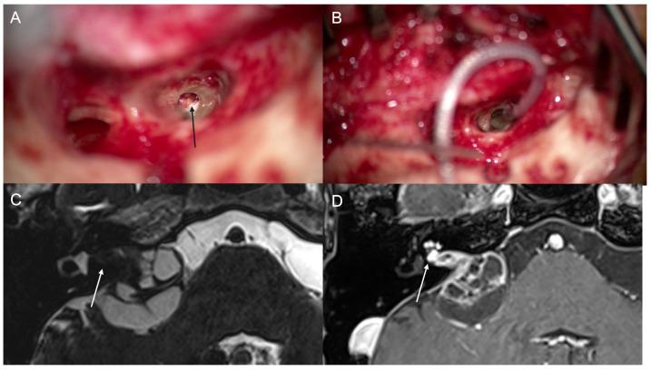 https://cdn.ncbi.nlm.nih.gov/pmc/blobs/650e/11172463/8702bb1eabfd/jcm-13-03042-g004.jpg