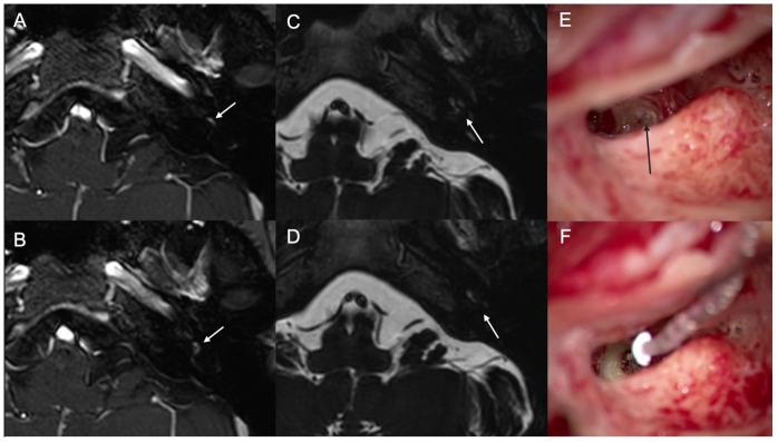 https://cdn.ncbi.nlm.nih.gov/pmc/blobs/650e/11172463/fa485073681e/jcm-13-03042-g002.jpg