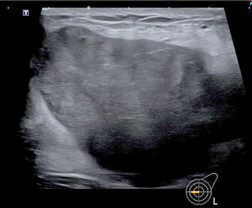 https://cdn.ncbi.nlm.nih.gov/pmc/blobs/6517/12239182/4f0c4c473129/amed-32-190-g004.jpg