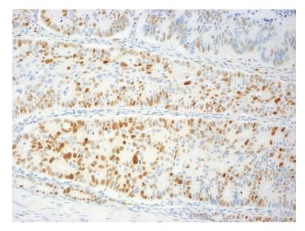 https://cdn.ncbi.nlm.nih.gov/pmc/blobs/6518/2796221/61250d7f6d5e/GRP2009-285830.002.jpg