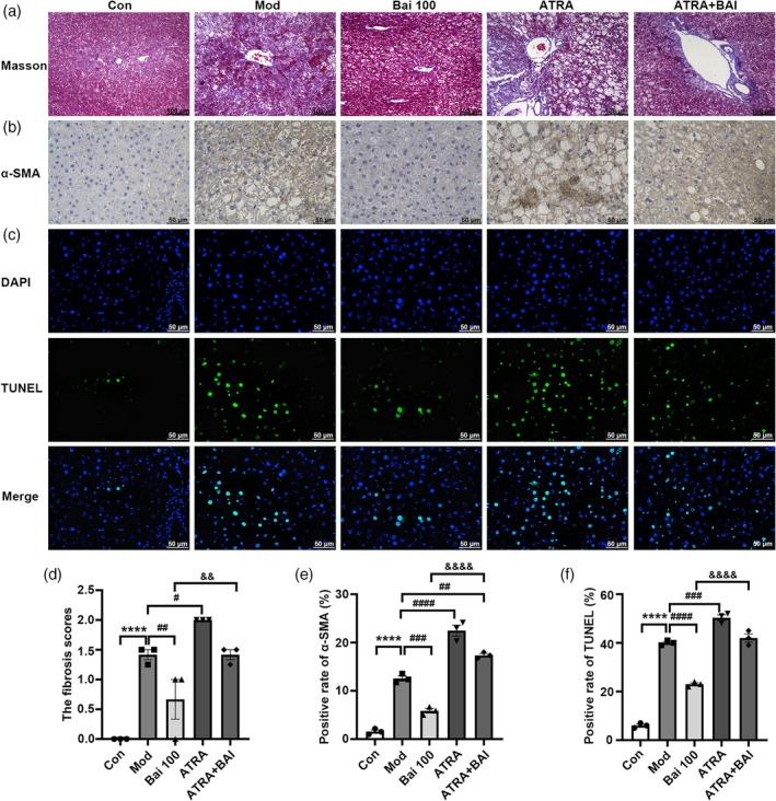 https://cdn.ncbi.nlm.nih.gov/pmc/blobs/651b/12013857/c3f189b33b6b/PTR-39-1663-g004.jpg