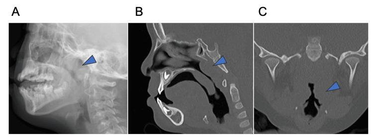 https://cdn.ncbi.nlm.nih.gov/pmc/blobs/651c/11222335/f534fe023aec/cureus-0016-00000061621-i03.jpg