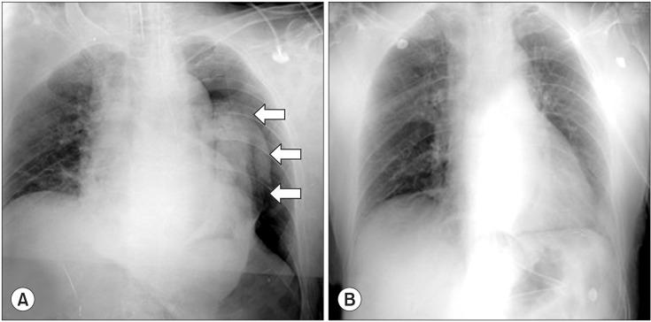 https://cdn.ncbi.nlm.nih.gov/pmc/blobs/6527/4754276/e7c55f3328dd/kjae-69-88-g002.jpg