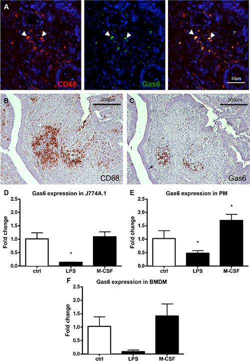 https://cdn.ncbi.nlm.nih.gov/pmc/blobs/652b/5302919/0d36bf45f087/oncotarget-07-56355-g003.jpg
