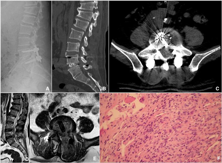 https://cdn.ncbi.nlm.nih.gov/pmc/blobs/652c/9852336/12ac3b148f0c/fsurg-09-1024510-g003.jpg