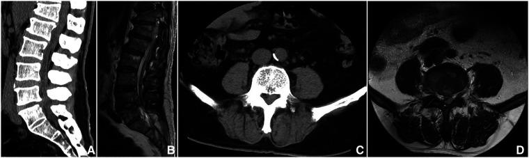 https://cdn.ncbi.nlm.nih.gov/pmc/blobs/652c/9852336/43727dbe4290/fsurg-09-1024510-g001.jpg