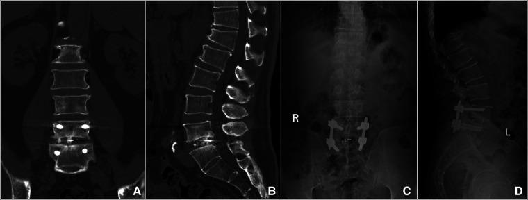 https://cdn.ncbi.nlm.nih.gov/pmc/blobs/652c/9852336/d4d3d8fc9707/fsurg-09-1024510-g004.jpg