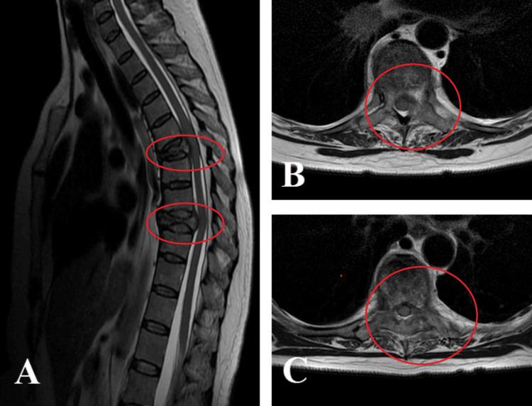 https://cdn.ncbi.nlm.nih.gov/pmc/blobs/652e/11523553/30d680b2540a/cureus-0016-00000070503-i06.jpg