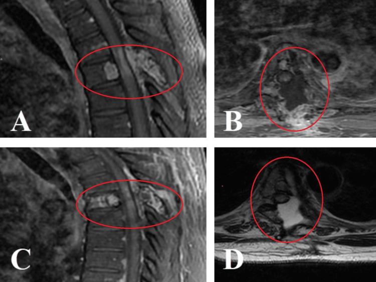 https://cdn.ncbi.nlm.nih.gov/pmc/blobs/652e/11523553/59e34a429c7a/cureus-0016-00000070503-i05.jpg