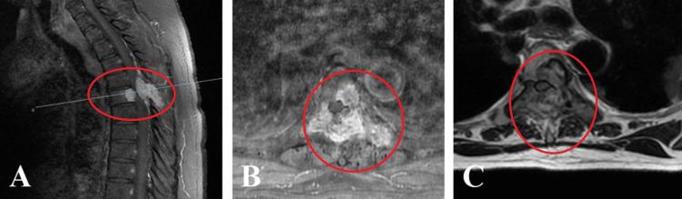 https://cdn.ncbi.nlm.nih.gov/pmc/blobs/652e/11523553/b59722f4c90c/cureus-0016-00000070503-i04.jpg