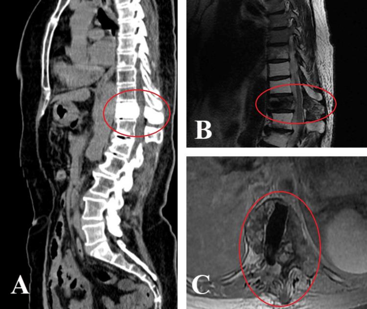 https://cdn.ncbi.nlm.nih.gov/pmc/blobs/652e/11523553/b7b5ec0d1658/cureus-0016-00000070503-i02.jpg