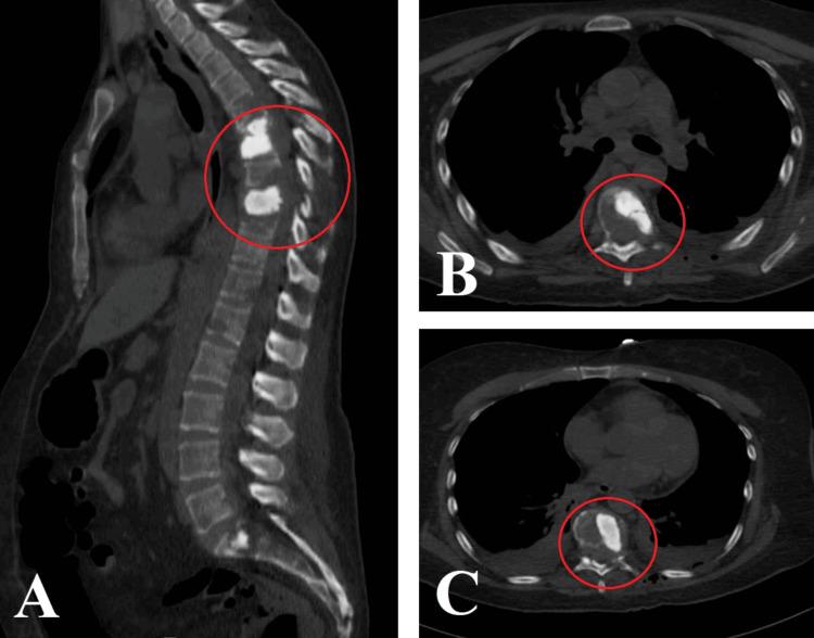 https://cdn.ncbi.nlm.nih.gov/pmc/blobs/652e/11523553/f4b6906fd037/cureus-0016-00000070503-i07.jpg