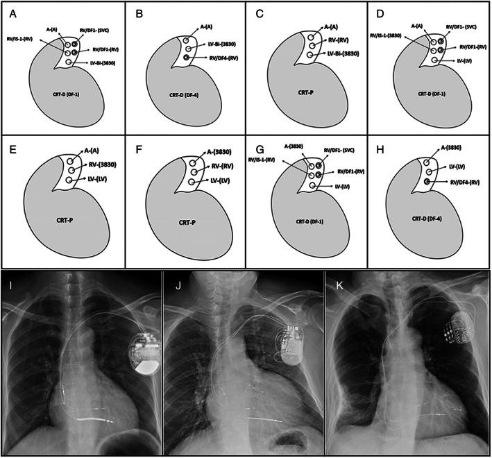 https://cdn.ncbi.nlm.nih.gov/pmc/blobs/6533/7373885/8d56f576859e/EHF2-7-1711-g001.jpg
