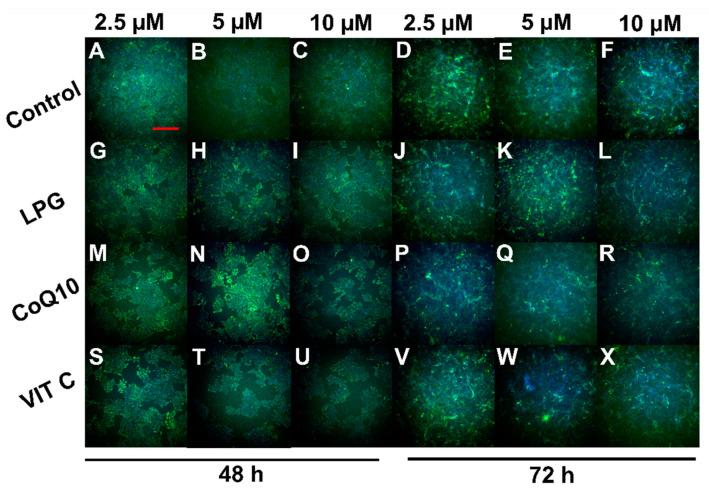 https://cdn.ncbi.nlm.nih.gov/pmc/blobs/6537/10301544/6938cbf5e18c/pharmaceuticals-16-00905-g006.jpg