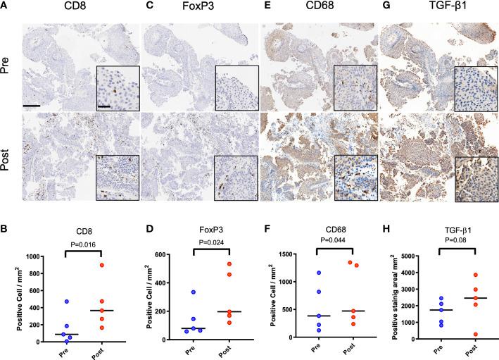 https://cdn.ncbi.nlm.nih.gov/pmc/blobs/653a/9902765/cafbd280589d/fimmu-14-1070196-g001.jpg