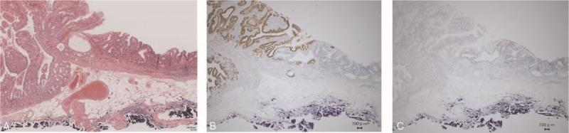 https://cdn.ncbi.nlm.nih.gov/pmc/blobs/653c/5466225/efe44489fe1d/medi-96-e7080-g005.jpg