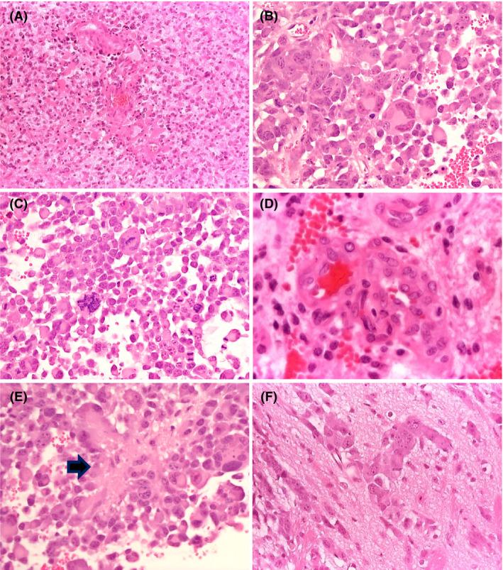 https://cdn.ncbi.nlm.nih.gov/pmc/blobs/6541/7379954/a9ea4729f3f6/NAN-45-119-g003.jpg